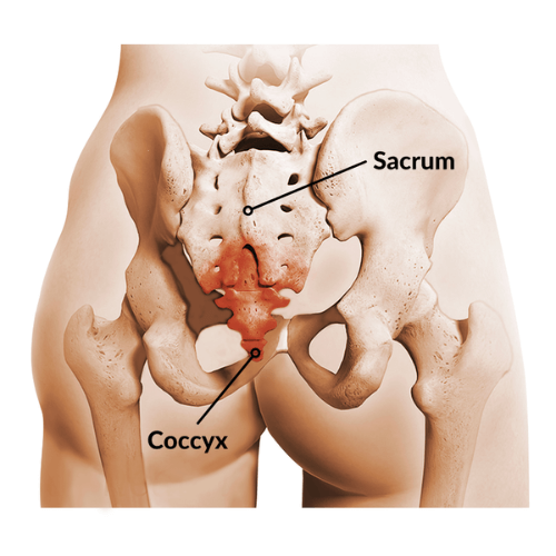 Anatomical illustration of the lower spine and pelvis highlighting the sacrum and coccyx.