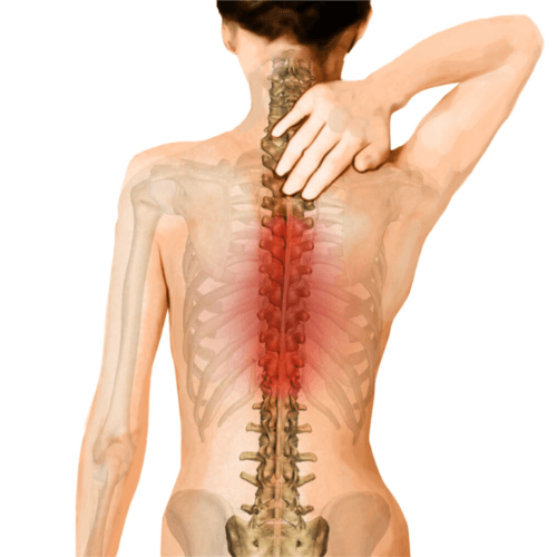 Woman holding upper back with highlighted thoracic spine, indicating pain or injury.