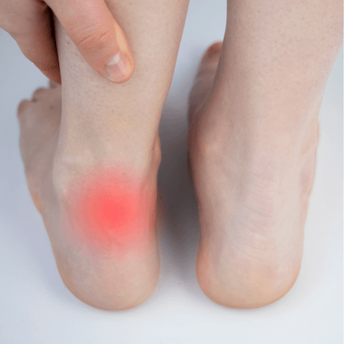 Person pointing to the back of the heel showing pain from Achilles tendinopathy.