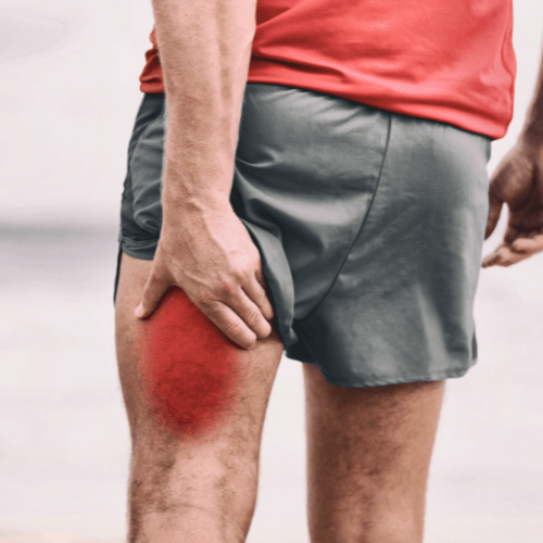 Person holding the back of the thigh with highlighted pain indicating a hamstring strain.