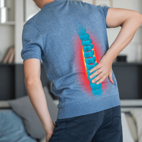 Dry Needling for Lumbar Sprain | Cole Pain Therapy Group