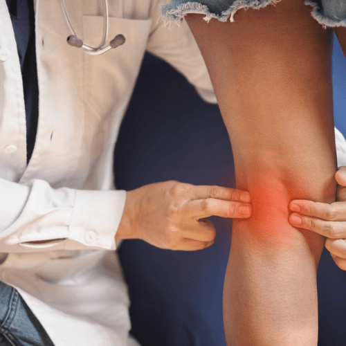 Clinician examining the back of the knee with highlighted pain indicating a popliteal cyst.